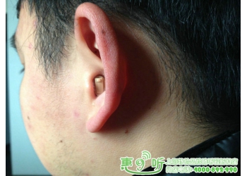上海特价助听器折扣店隐形助听器 